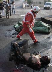 badly burnt body